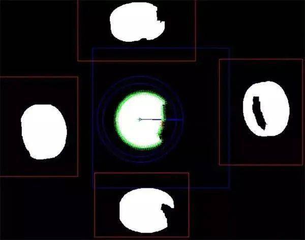 藥片缺陷檢測方案-機器視覺_視覺檢測設備_3D視覺_缺陷檢測