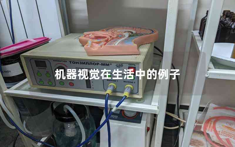 機(jī)器視覺在生活中的例子